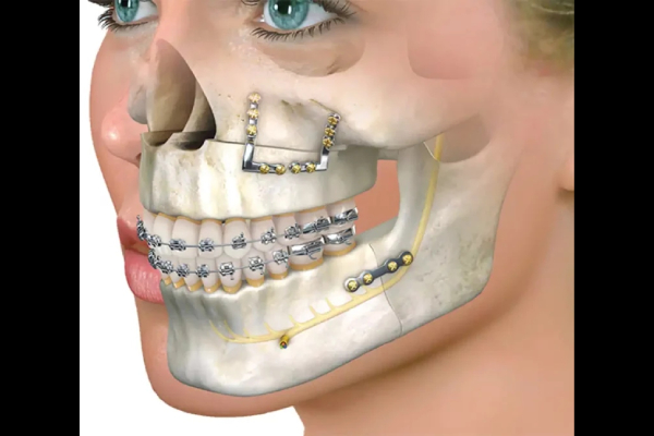 Oral Surgery